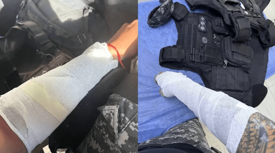 Córdoba: dos agentes policiales sufren quemaduras tras ser atacados con agua&nbsp;hirviendo