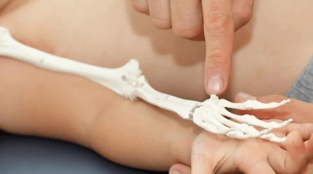 Argentina cuenta con el primer fármaco para tratar la&nbsp;acondroplasia